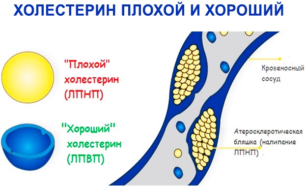 Плохой и хороший холестерин