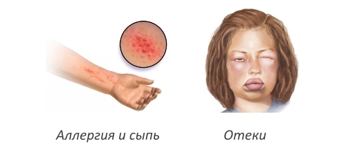 Побочные действия Discus compositum