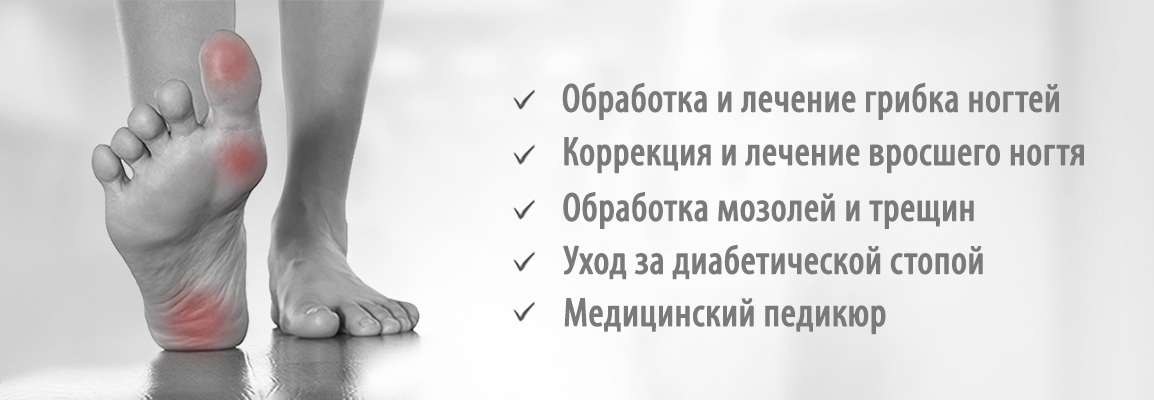 Подологические процедуры