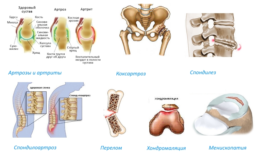 Показания для Биартрина