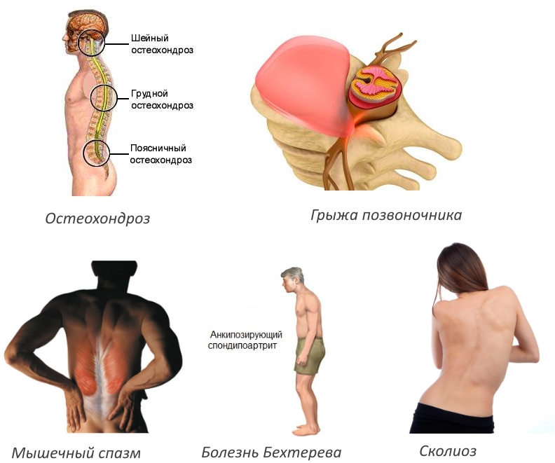 Показания для использования качелей Яловицына