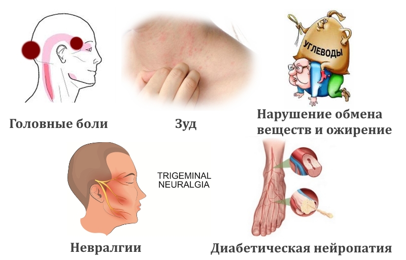 Показания для применения капсаицина