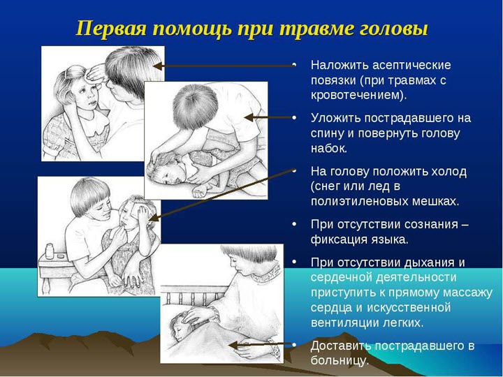 Помощь при травме головы
