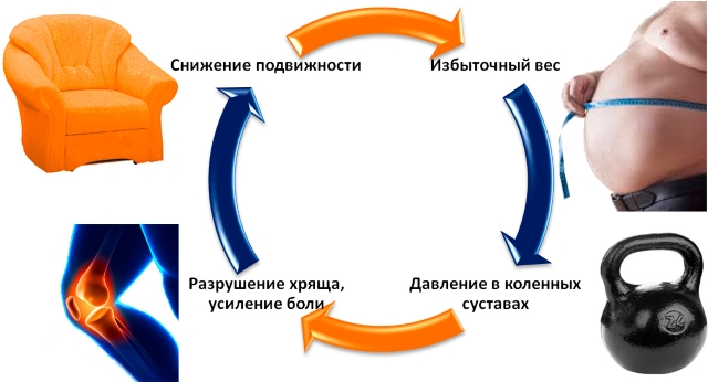Зависимость ожирения и остеоартроза коленного сустава