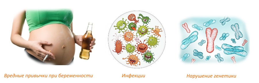 Причины хондродистрофии