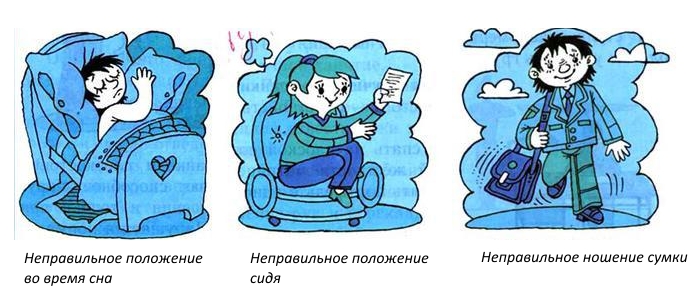 Частые причины нарушения осанки