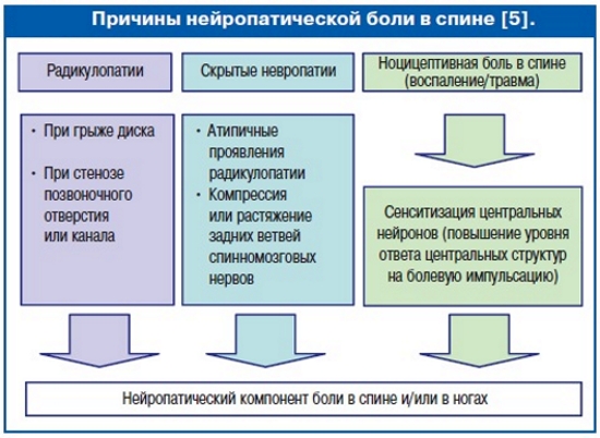 Причины нейропатической боли в спине