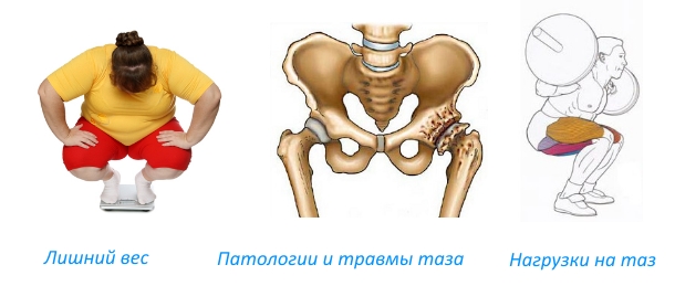 Причины остеосклероза тазобедренного сустава