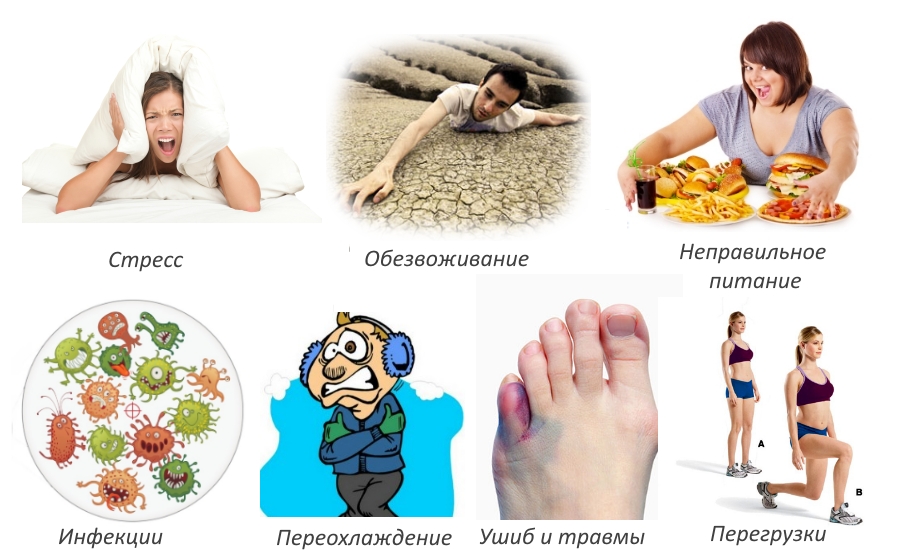Причины подагрического артрита