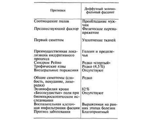 Признаки эозинофильного фасциита
