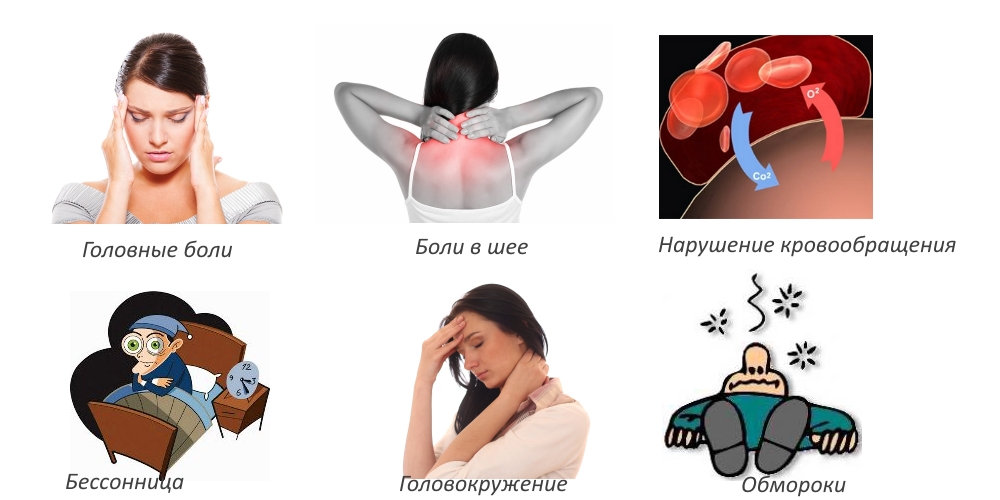 Признаки грыжи шейного отдела позвоночника