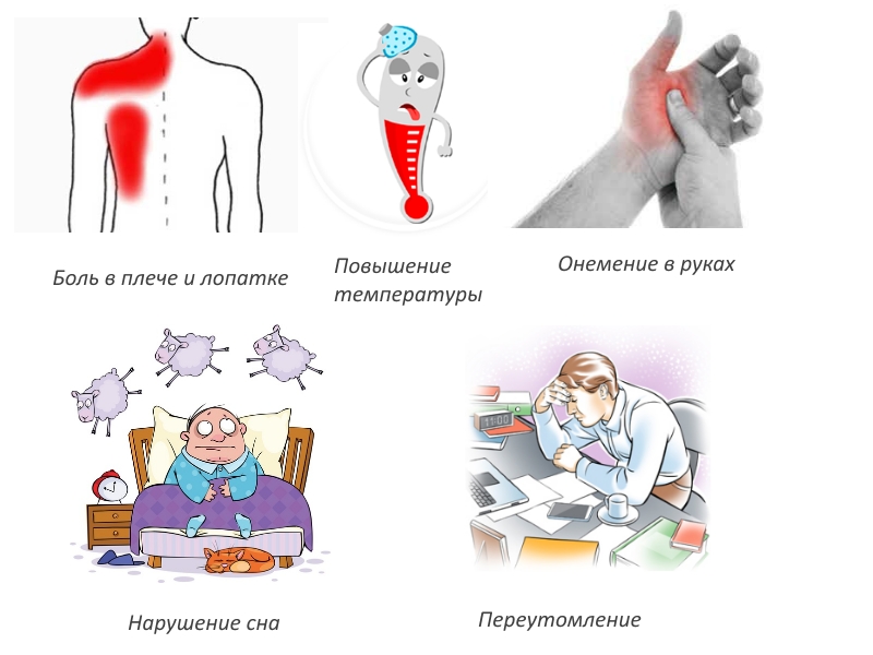 Признаки периартрита плеча