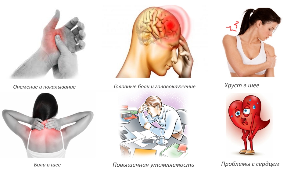Признаки артроза шеи