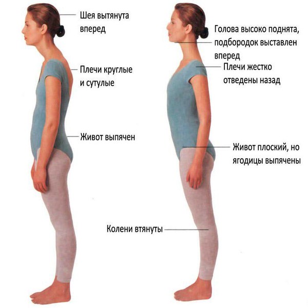 Признаки сутулости