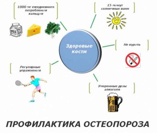 Профилактика остеопороза