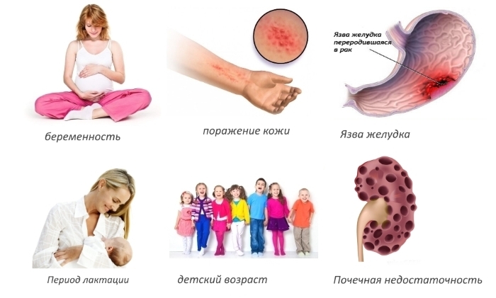 Противопоказания для Хондроксида форте