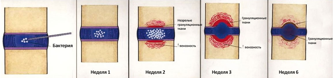 Разрушение диска