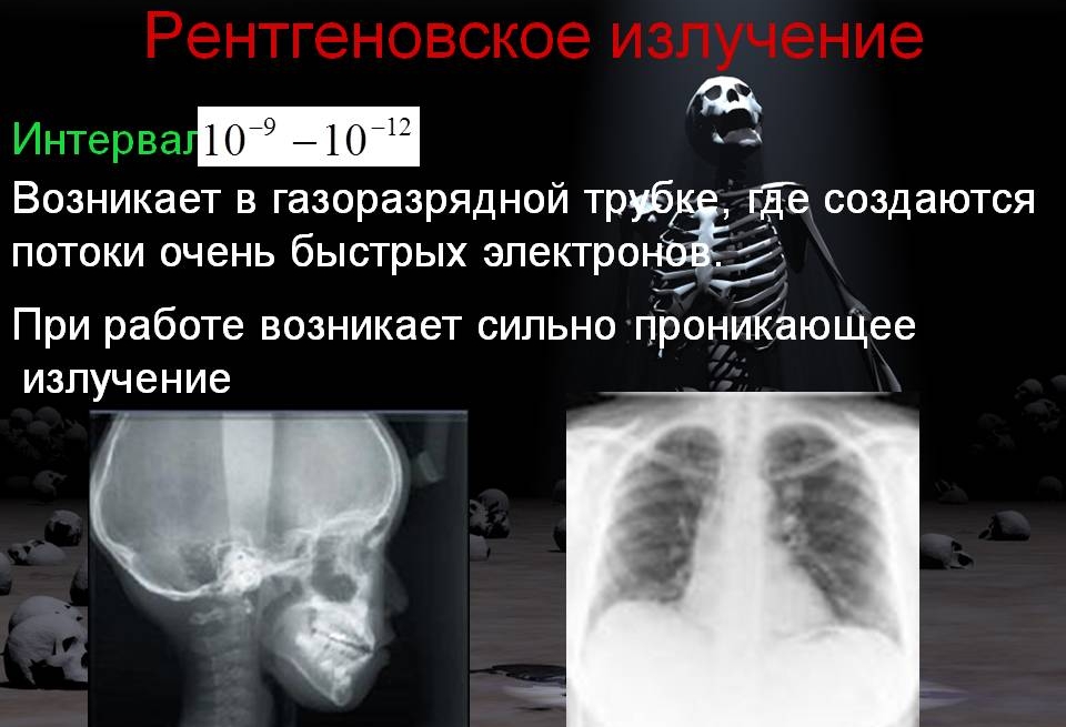 Рентген излучение