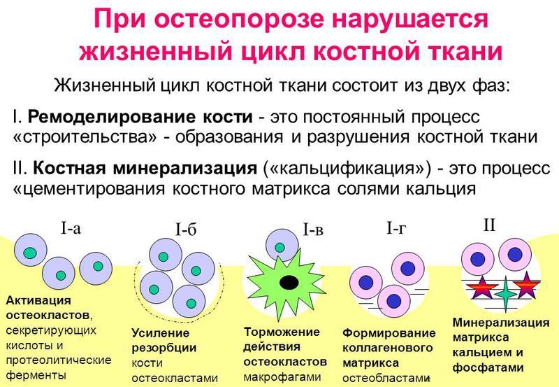 Резорбция костной ткани