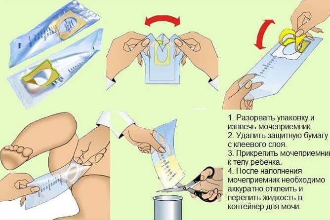 Сбор детской мочи
