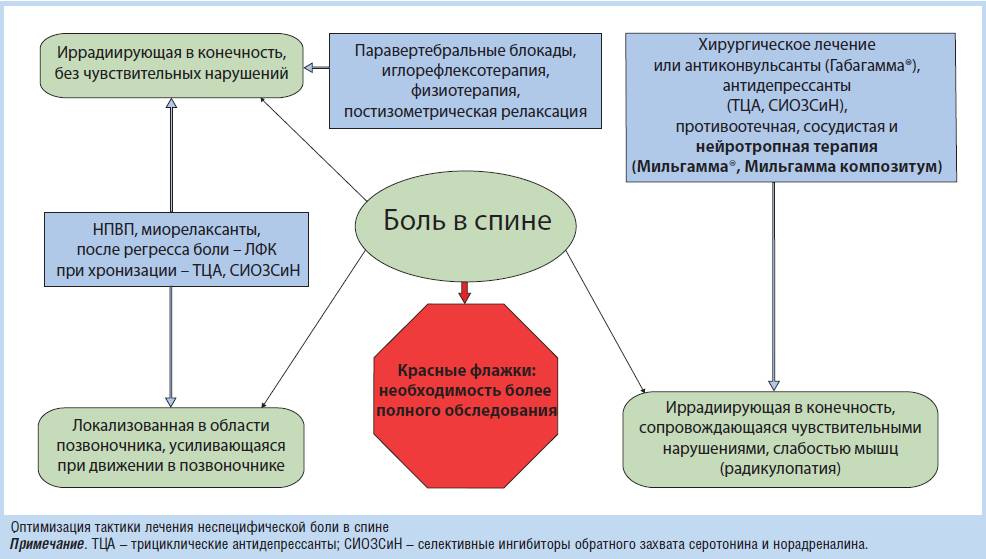 Схема лечения радикулопатии