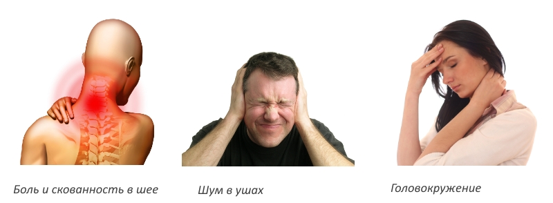 Симптомы вертеброгенной цервикалгии