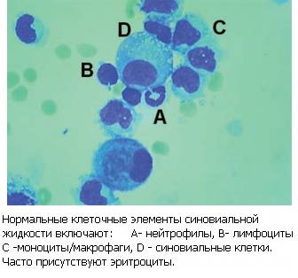 Состав синовиальной жидкости