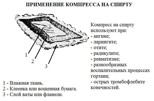 Спиртовой компресс