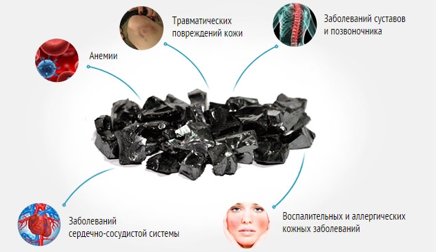 Применение шунгита