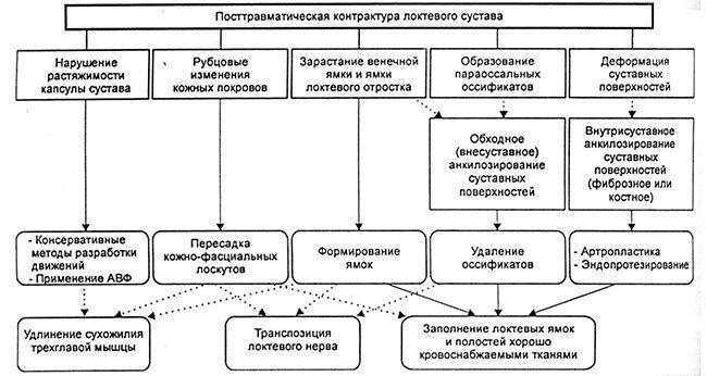 Причины и терапия посттравматической контрактуры