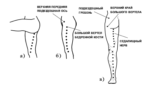 Точки для массажа ноги при защемлении