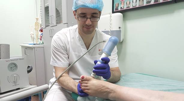 Ударно-волновая терапия косточки на ноге