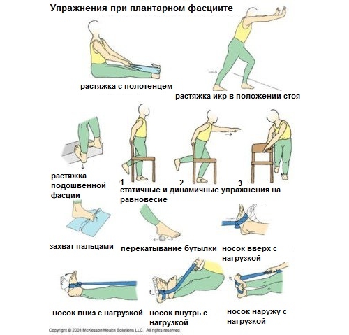 Упражнения при пяточной шпоре
