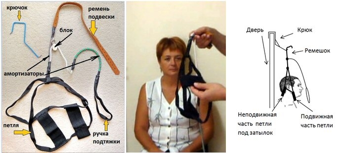 Устройство петли Глиссона
