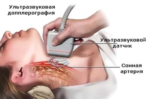 УЗИ сосудов шеи