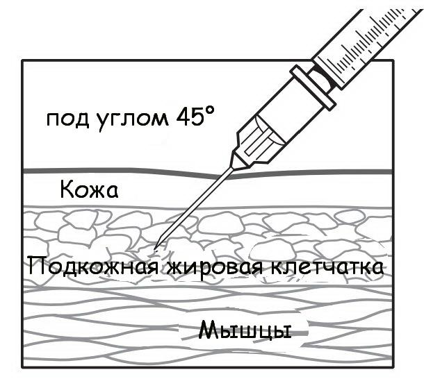 Внутрикожное введение препарата