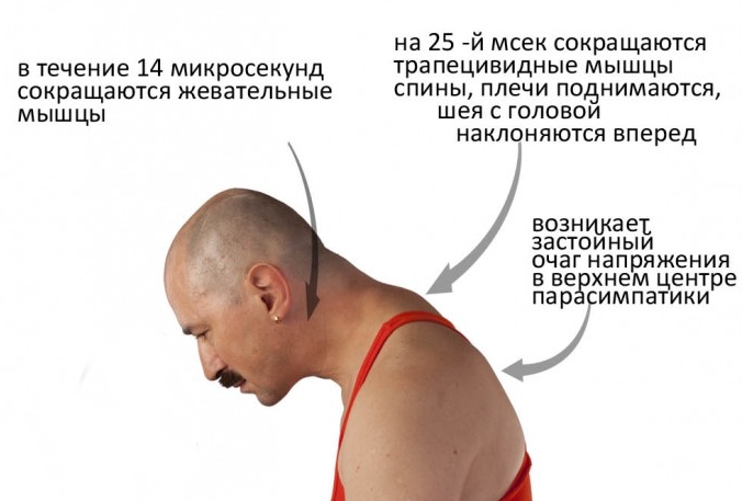 Воздействие стресса на спину