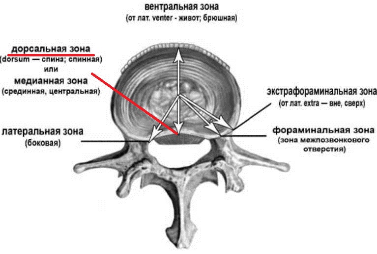 Возможные зоны образования грыжи