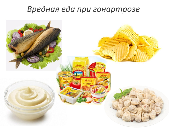 Вредные продукты при гонартрозе